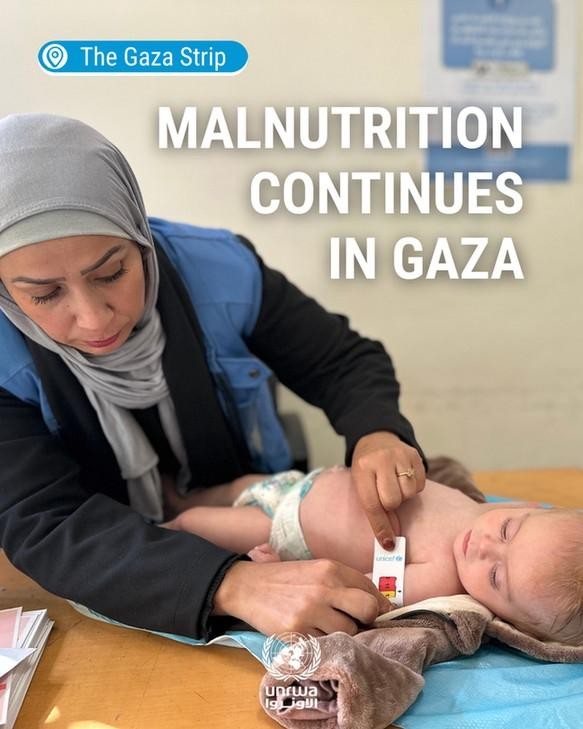 MALNUTRITION 
CONTINUES 
IN GAZA
